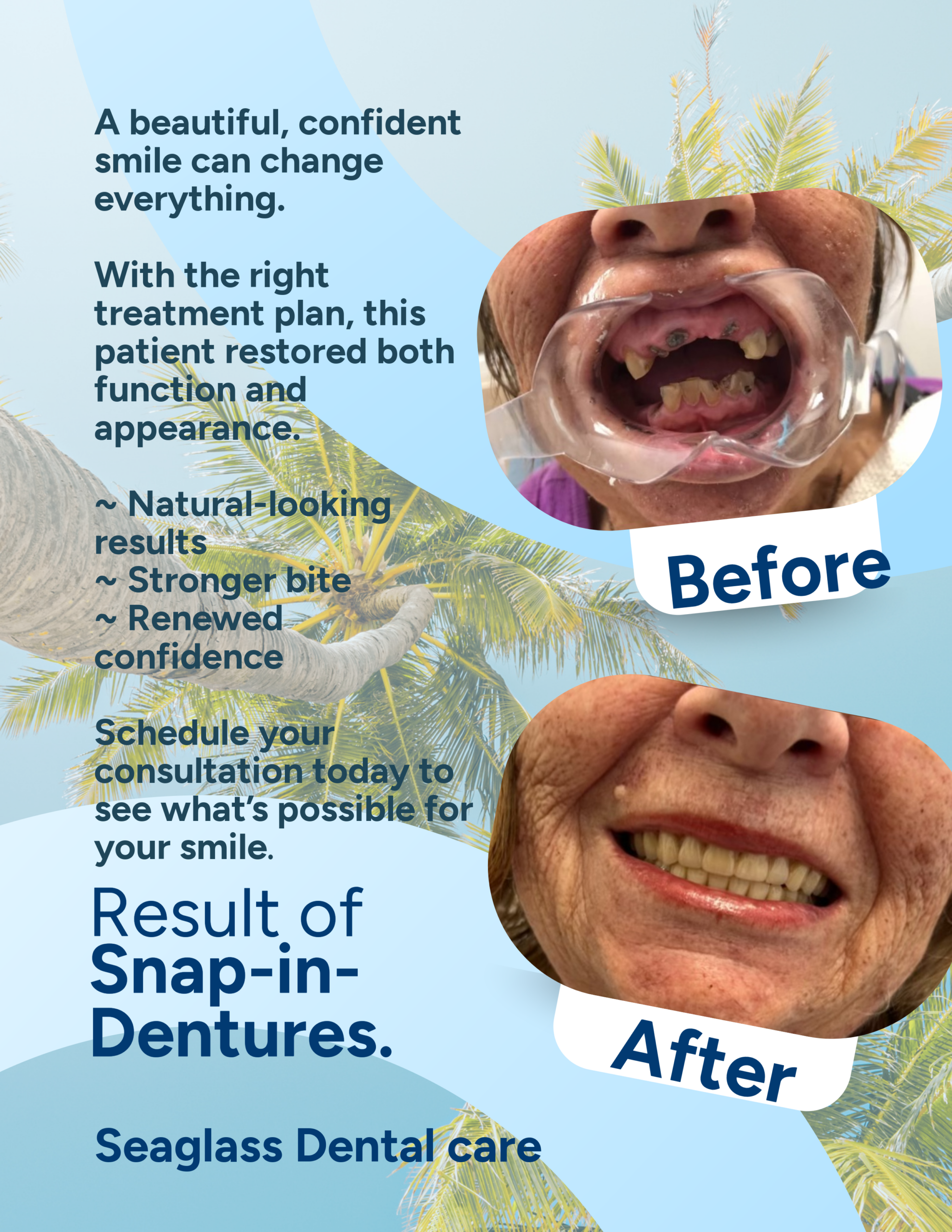 before and after Image